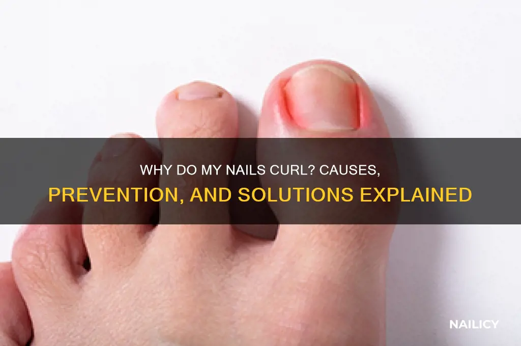 why do my nails curk