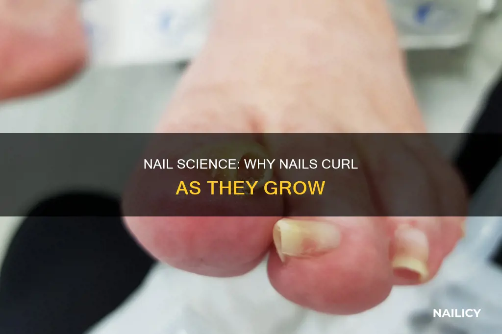 why do my nails curl as they grow