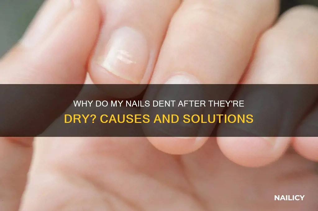 why do my nails dent after theyre dry