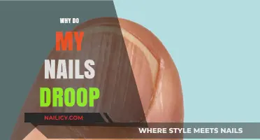 Why Do My Nails Droop? Causes and Solutions for Weak Nails