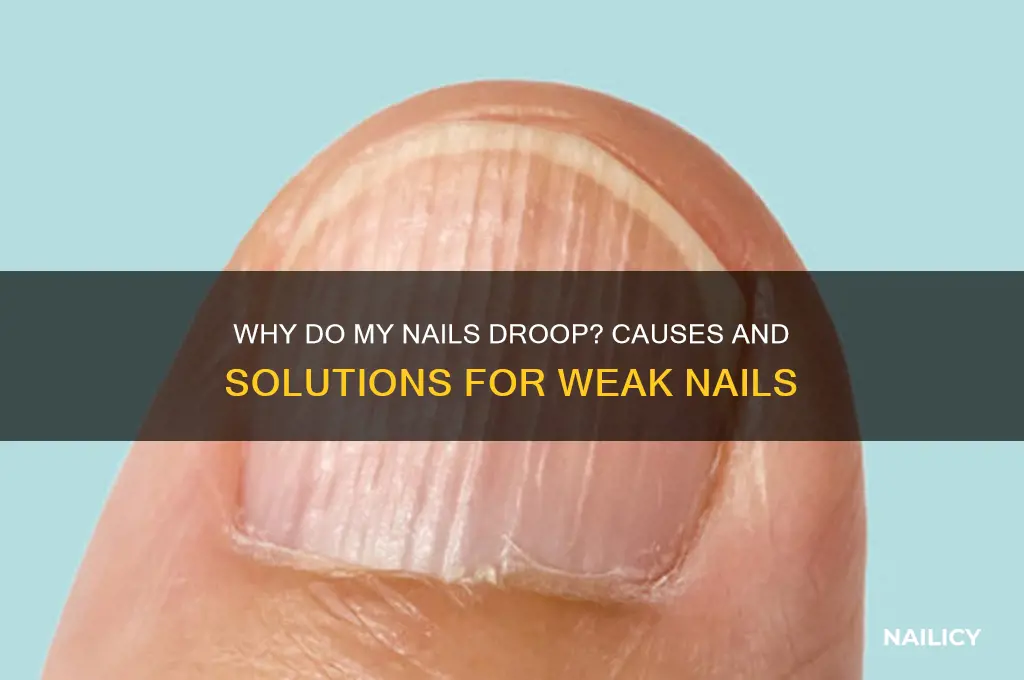 why do my nails droop