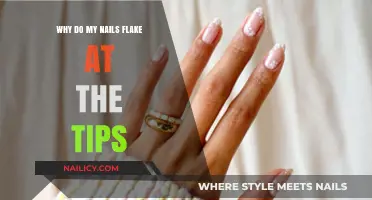 Why Do My Nails Flake at the Tips? Causes and Solutions