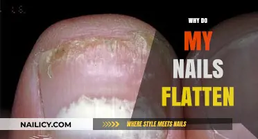 Why Do My Nails Flatten? Causes and Solutions for Flat Nails