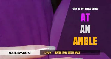 How Nails Growing at an Angle Affects You