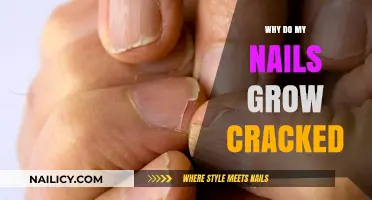 Cracked Nails: What's the Cause?