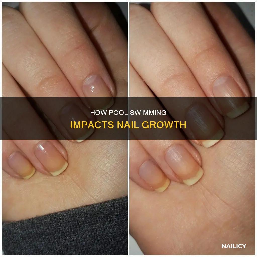 why do my nails grow in pools