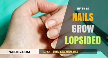 How to Fix Lopsided Nails: Causes and Solutions