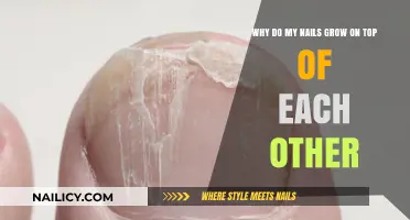 How Nails Growing on Top of Each Other?