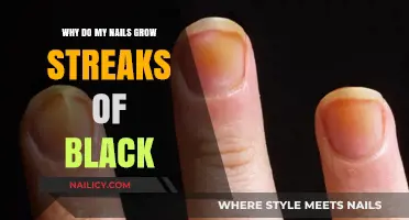 Nail Streaks: Black Growth and What it Means