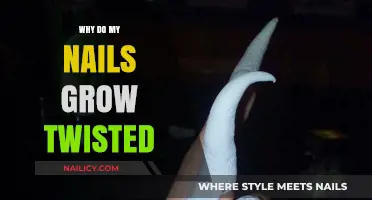 The Mystery of Twisted Nail Growth