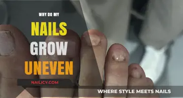 Uneven Nail Growth: Why Does It Happen?