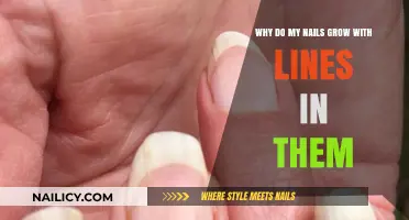 Vertical Ridges: Why Your Nails Develop Lines