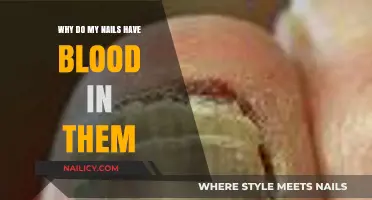 Why Do My Nails Have Blood? Causes and Solutions Explained