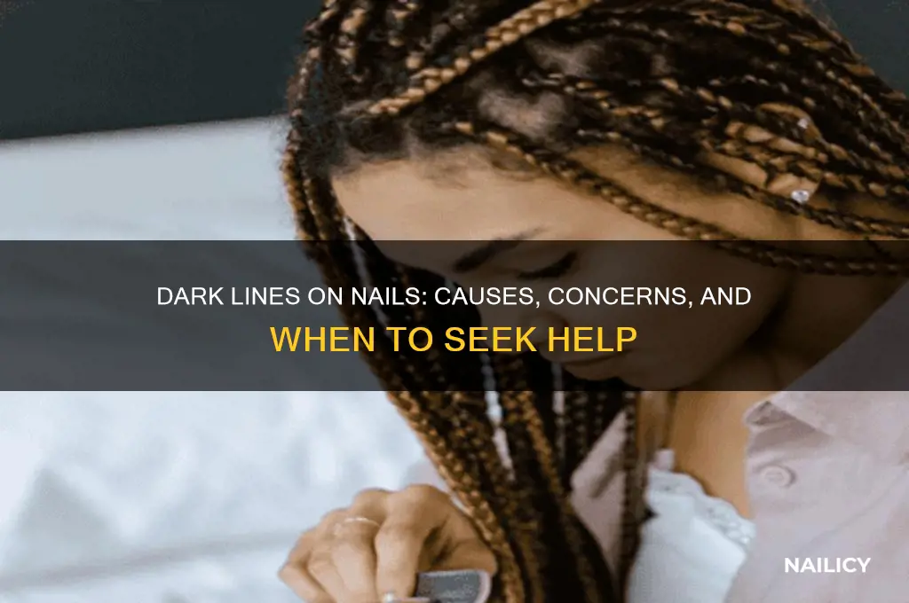 why do my nails have dark lines