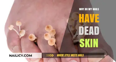 Why Do My Nails Have Dead Skin? Causes and Solutions