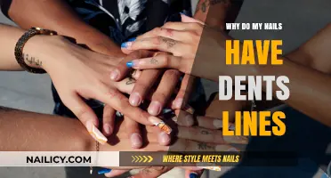 Understanding Nail Dents and Lines: Causes, Concerns, and Solutions Explained