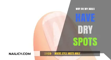 Dry Spots on Nails: Causes, Prevention, and Effective Solutions Explained