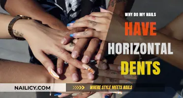 Horizontal Nail Dents Explained: Causes and Solutions for Healthy Nails