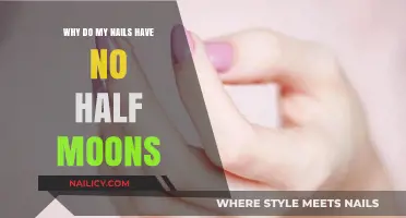 Missing Nail Half Moons: Causes and What They Reveal About Health