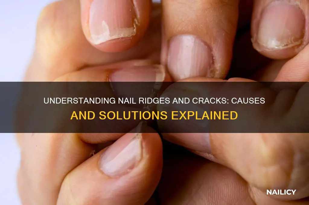 why do my nails have ridges and cracks