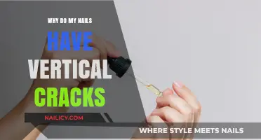Vertical Nail Cracks: Causes, Prevention, and Effective Treatment Solutions