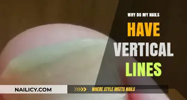 Vertical Lines on Nails: Causes, Concerns, and When to Seek Help