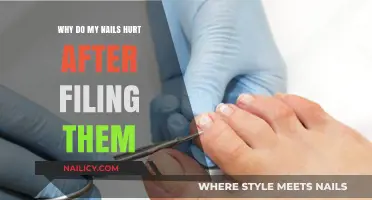 Why Do My Nails Hurt After Filing? Causes and Solutions
