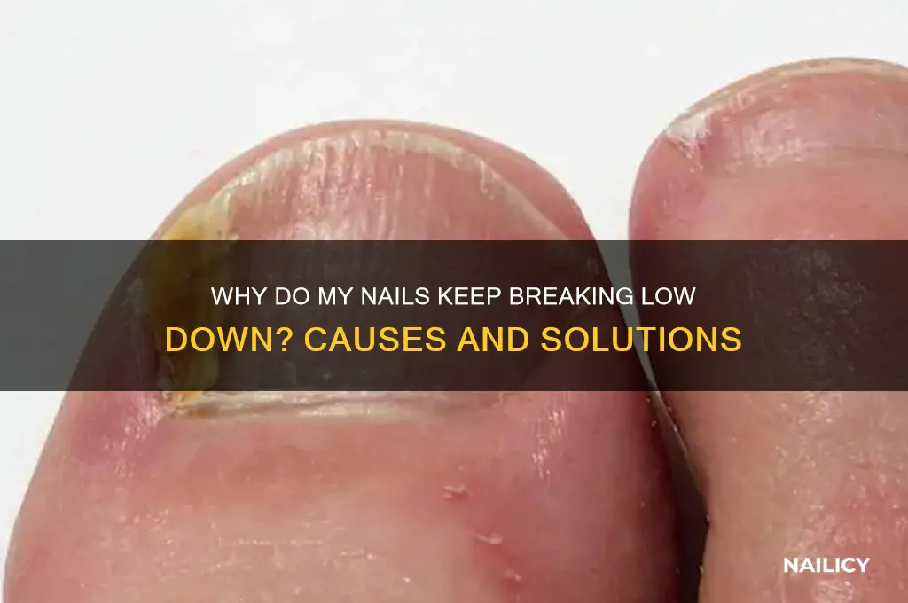 why do my nails keep breaking low down