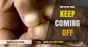 Why Do My Nails Keep Coming Off? Causes and Solutions