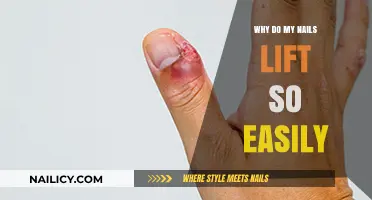 Why Do My Nails Lift Easily? Causes and Solutions Explained