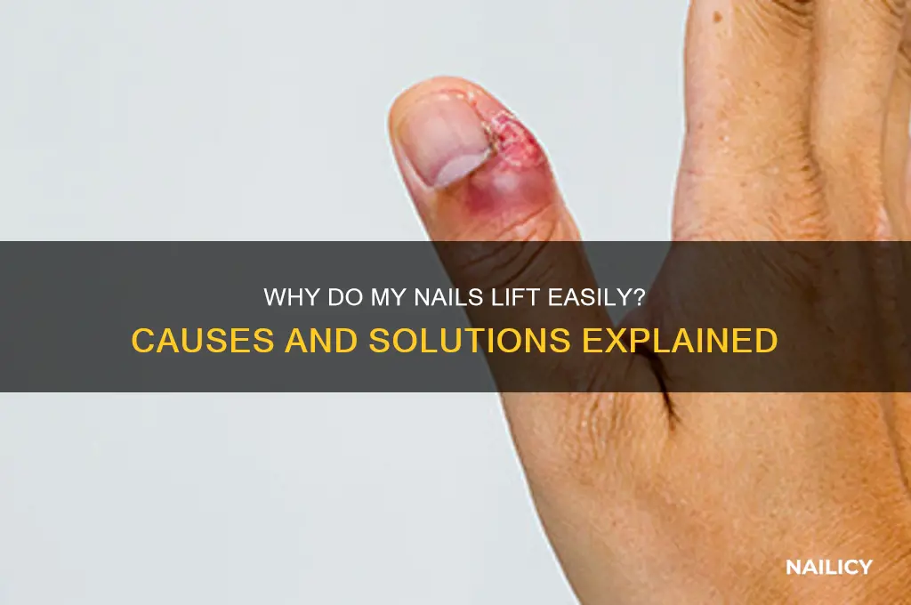 why do my nails lift so easily