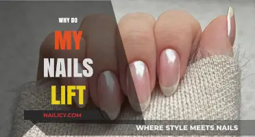 Why Do My Nails Lift? Causes and Solutions for Lifting Nails