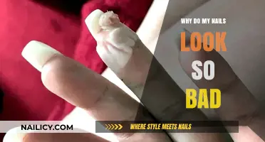 Why Do My Nails Look So Bad? Causes and Solutions