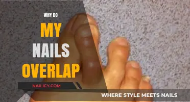 Why Do My Nails Overlap? Causes and Solutions Explained
