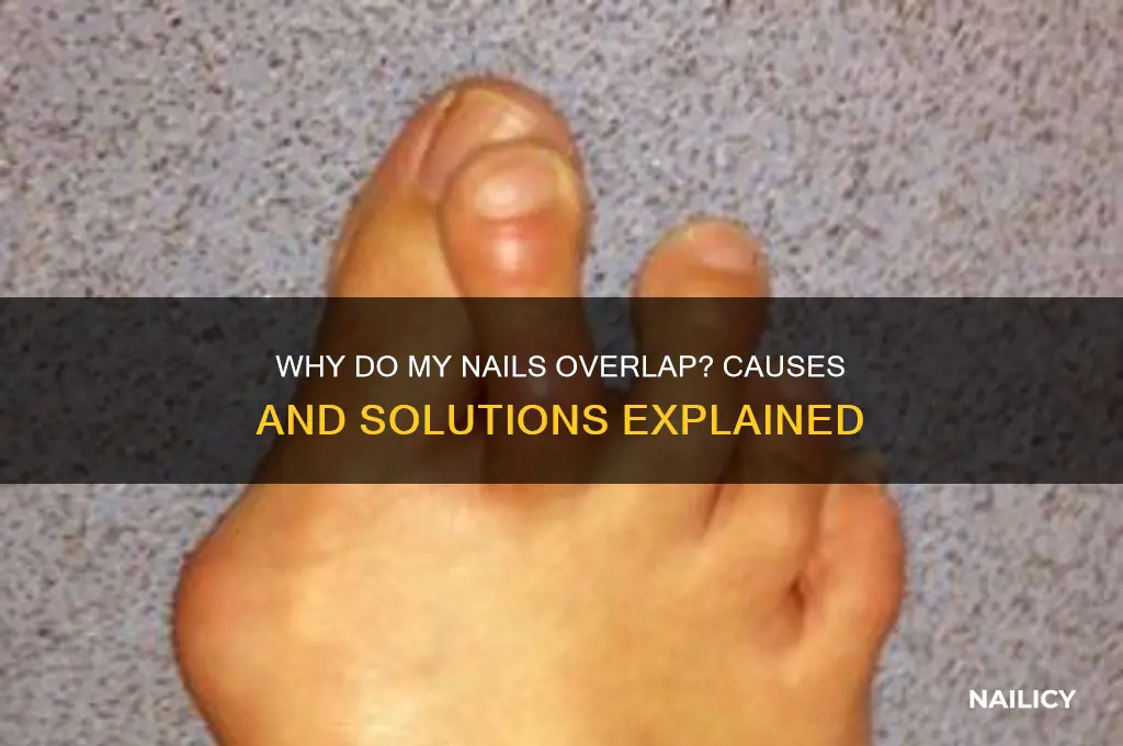 why do my nails overlap