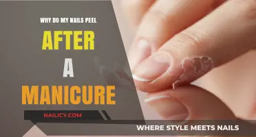 Why Do My Nails Peel After a Manicure? Causes and Solutions