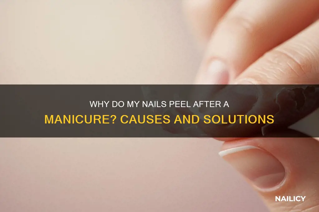 why do my nails peel after a manicure