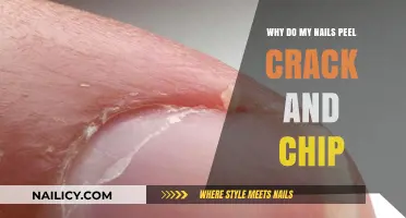 Why Do My Nails Peel, Crack, and Chip? Causes and Solutions