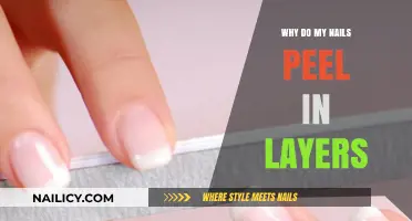 Why Do My Nails Peel in Layers? Causes and Solutions