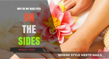 Why Do My Nails Peel on the Sides? Causes and Solutions