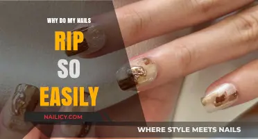 Why Do My Nails Rip So Easily? Causes and Solutions
