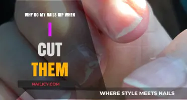 Nail Ripping: Why It Happens and How to Fix It