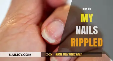Why Do My Nails Have Ripples? Causes and Solutions Explained