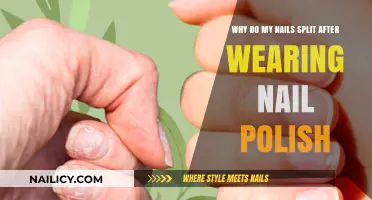 Why Do My Nails Split After Wearing Nail Polish?