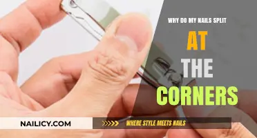 Why Do My Nails Split at the Corners? Causes and Solutions