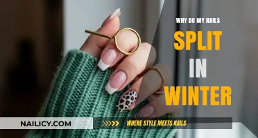 Why Do My Nails Split in Winter? Causes and Solutions