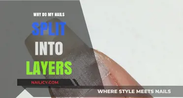 Why Do My Nails Split into Layers? Causes and Solutions