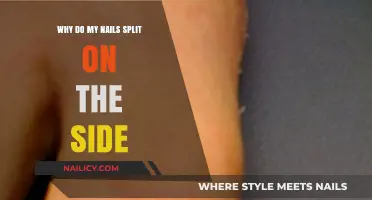 Why Do My Nails Split on the Side? Causes and Solutions