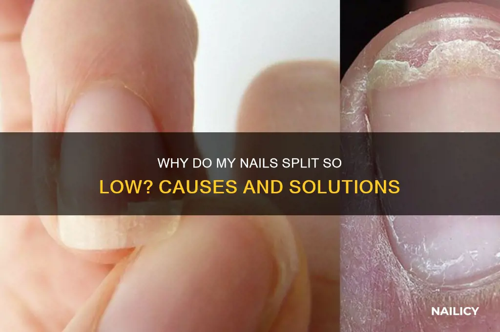 why do my nails split so low
