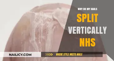 Why Do My Nails Split Vertically? NHS Insights and Solutions